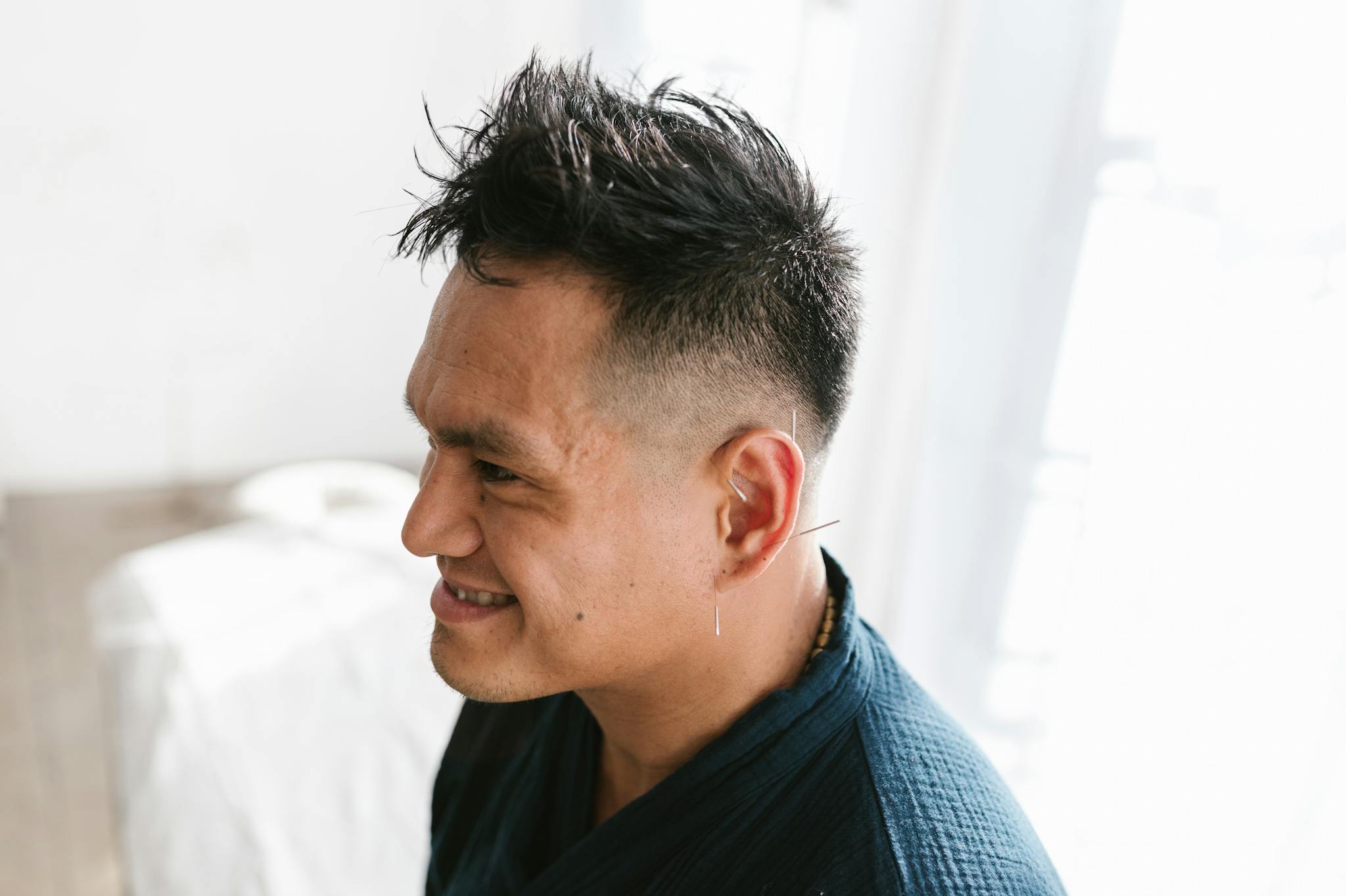 A smiling man getting acupuncture treatment on his ear in a bright room, promoting wellness.